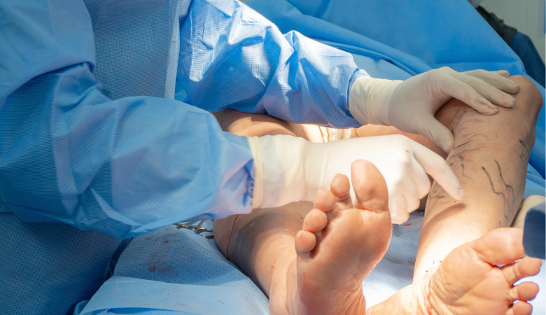 cirugia-venosa-laser-