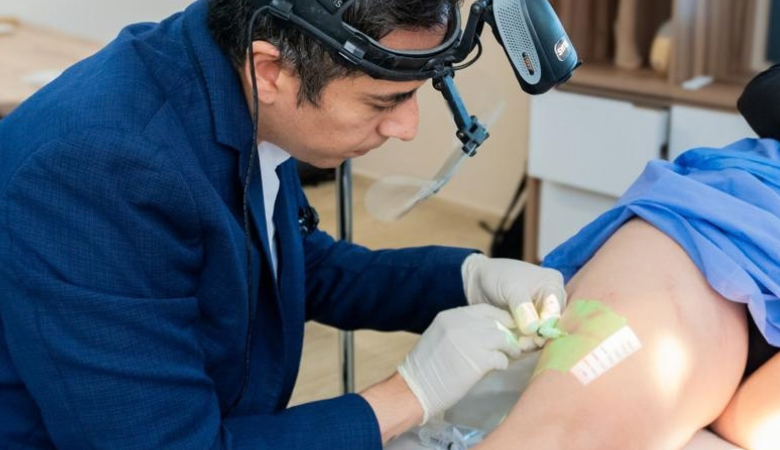escleroterapia-